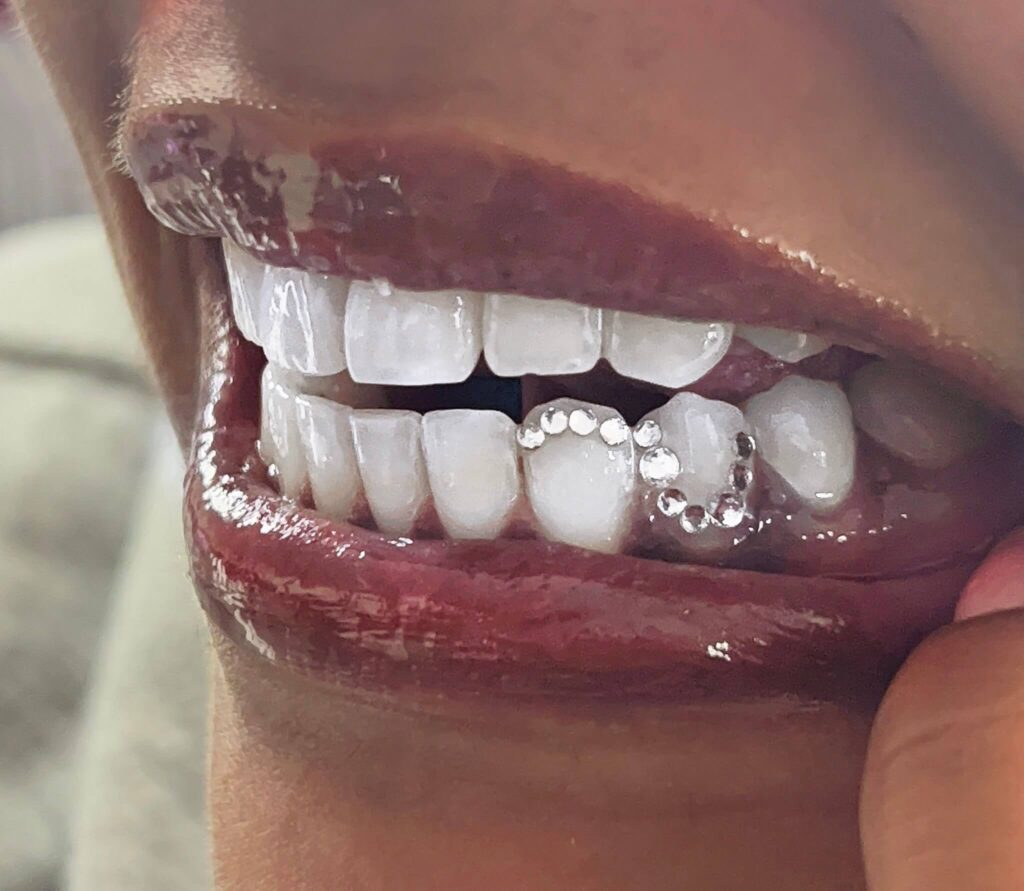 tandkristallen den haag 5